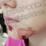Бездомная собака напала на 10-летнюю девочку в Ставрополе - ATVmedia.Ru