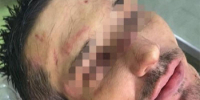 Садистам из пятигорского рехаба с бесчеловечными пытками назначили наказание - Bloknot-Stavropol.Ru